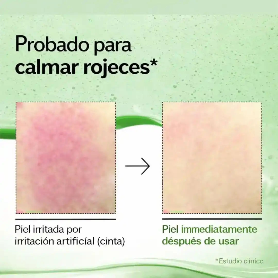 RedCalm™ Azelaic Serum – Suero Calmante con Ácido Azelaico para una Piel Más Uniforme