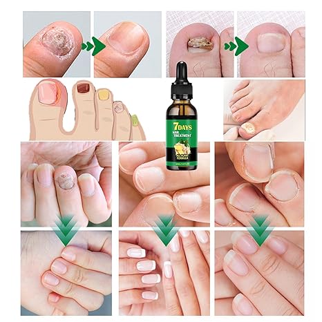 JAYSUNG® | Nail Renewal - Tratamiento para Uñas con Apariencia Más Saludable y Fuerte